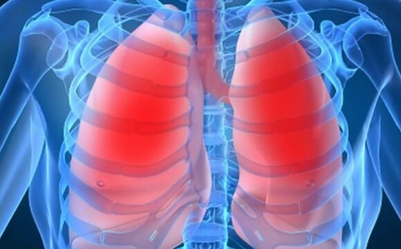 Бронхіальна астма в період COVID-19
